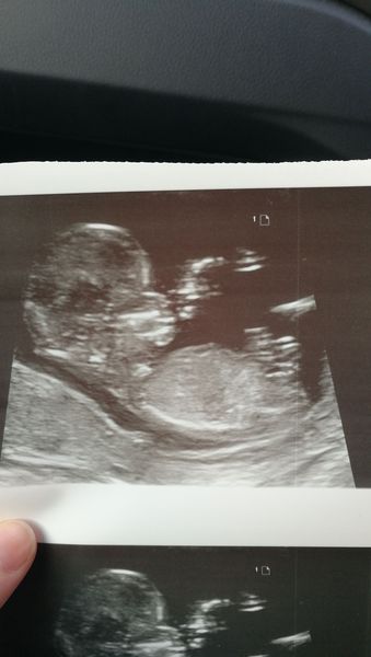 August 2019 4: All the scans and hopefully the end of nausea