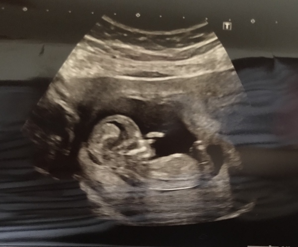 September 2019 Babies - Thread #3