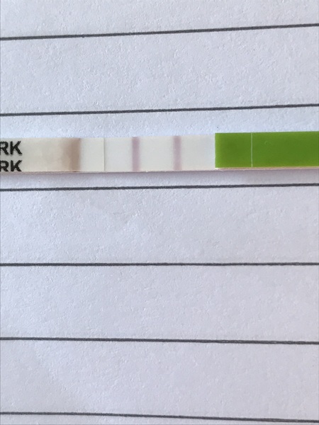 Line eyes 1 month after MC.