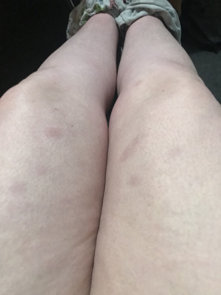 Any medical types about - not sure what’s wrong (picture)