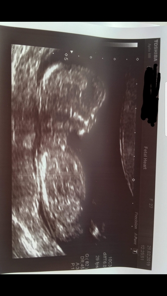 August 2019 4: All the scans and hopefully the end of nausea