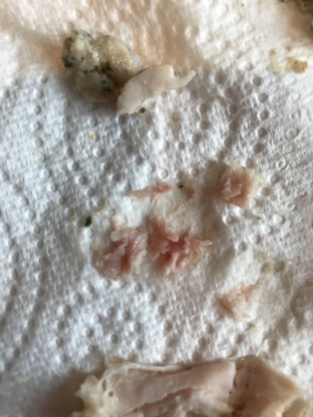 To be worried about this pink meat in my chicken sandwich