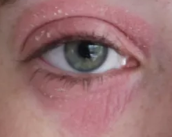 Am I ill, or just a middle-aged woman?