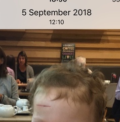 Help! Scar on my LO's face