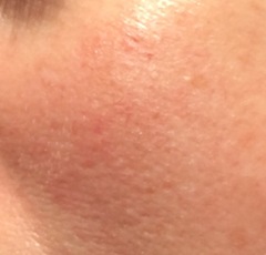 40 and suddenly look like shit. Could I get a skin intervention?