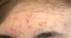 Help with blood test results please (pics)