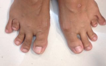 Weird toes