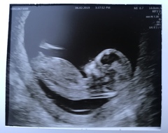 Gender guesses, bit of fun