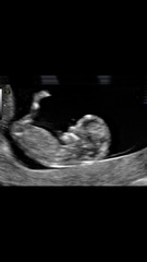 Gender guesses please you clever lot?!