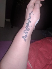 Carpol tunnel 5 day's post op