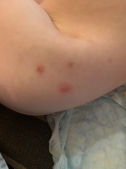 Any idea what these spots are?
