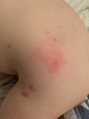 Any idea what these spots are?