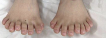 Weird toes