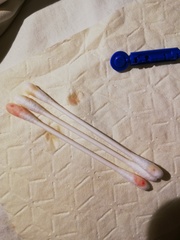 To lance this? (Dental)