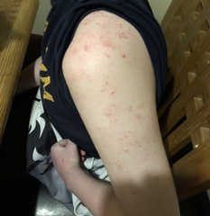 Help with blood test results please (pics)