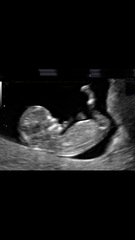 Gender guesses please you clever lot?!
