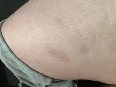 Any medical types about - not sure what’s wrong (picture)