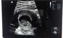 9 week scan guesses?