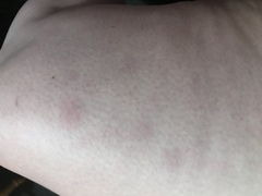 Any medical types about - not sure what’s wrong (picture)
