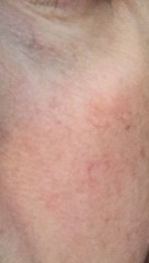 40 and suddenly look like shit. Could I get a skin intervention?