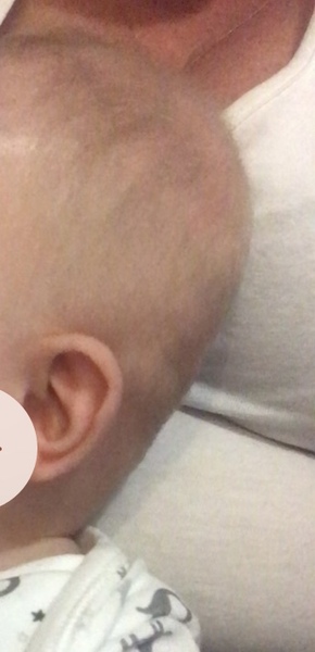 My baby has a flat head 😔