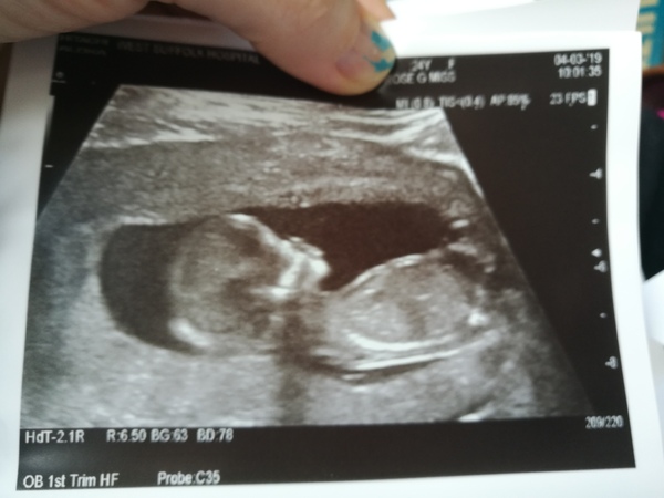 September 2019 Babies - Thread #3