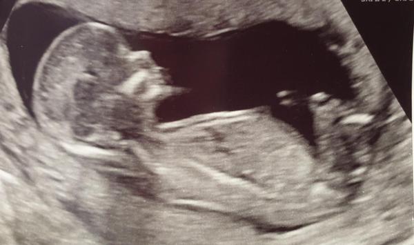 September 2019 babies - thread #4