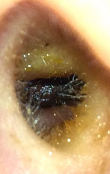 Is it earwax or a creature !