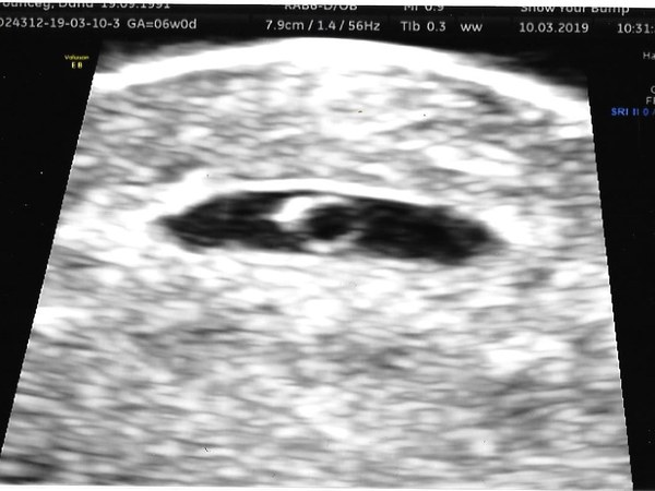 Due November 2019