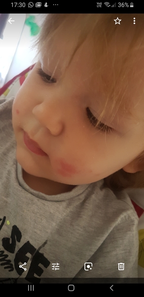 Cows milk allergy / rice allergy - any experience?