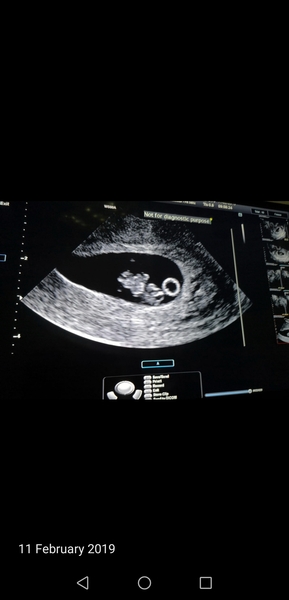 September 2019 Babies - Thread #3