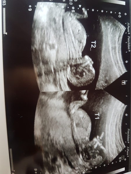 September 2019 babies - thread #4