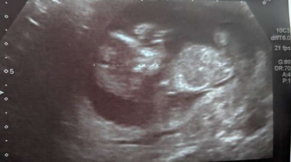 September 2019 Babies - Thread #3