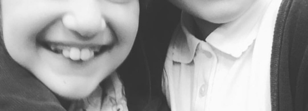 What was your dcs teeth like before braces? (NHS)