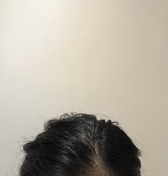 Any scientifically proven ways to reduce hair greasiness?!