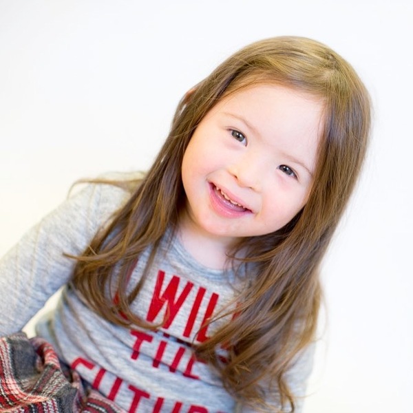 Baby has Down’s Syndrome