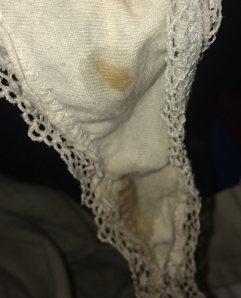 Possible weird implantation?