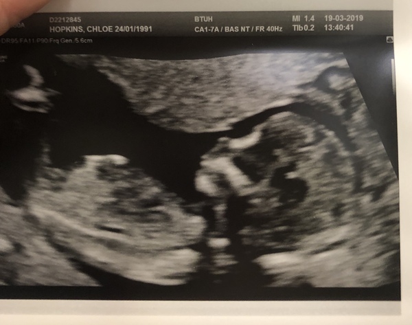 Gender predictions please 😃