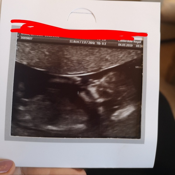 What gender do you think the baby is ?