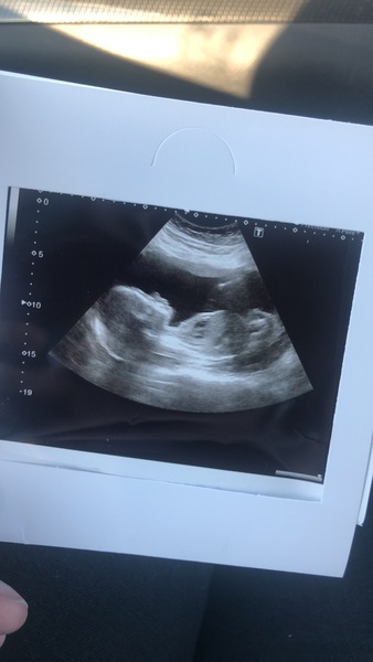 July 2019 (thread 9): shame me about my bump, and I'll shame you about your complete lack of manners