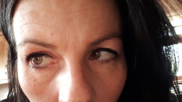 Hooded eyes