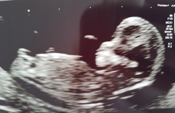 September 2019 Babies - Thread #3