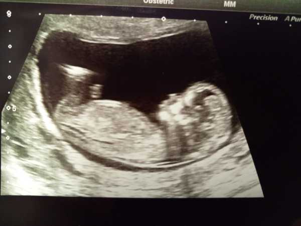 September 2019 babies - thread #4