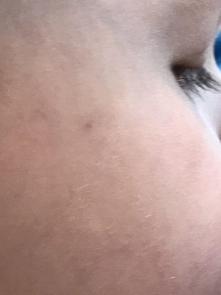 Spot