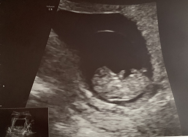 October 2019 thread 2
