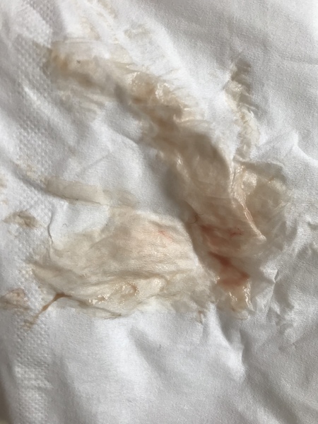 Possible implantation?