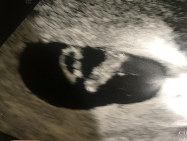 Due November 2019 Continued