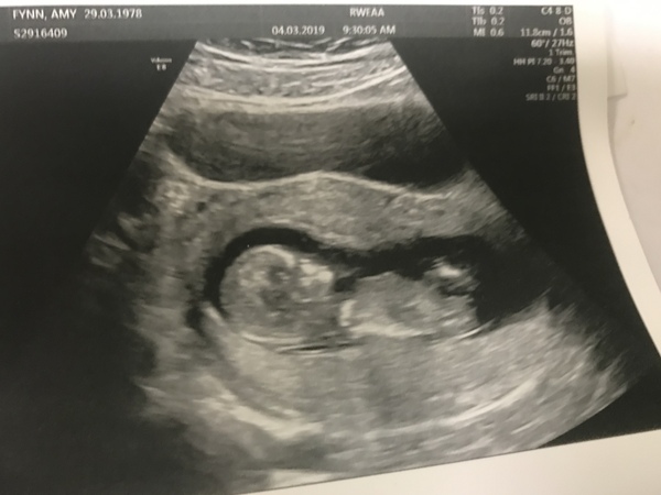 September 2019 Babies - Thread #3