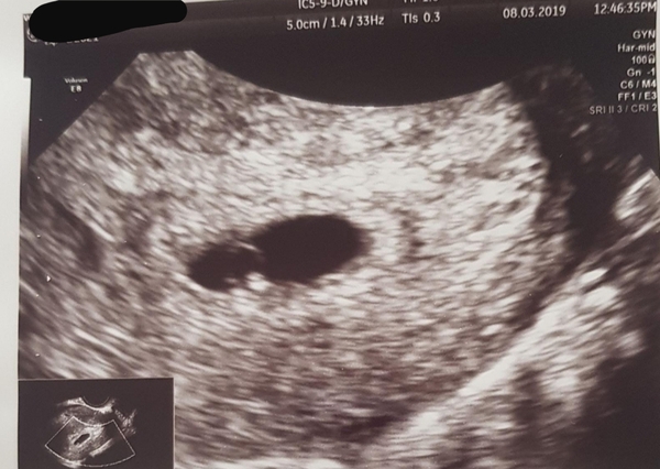 Happy 5 weeks pregnant chat.Due Nov 7th!