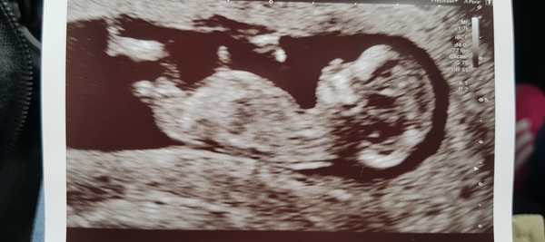 September 2019 Babies - Thread #3